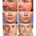 thumbnail image 4 of Retinol, esencia hidratante compacta que reduce los poros, botella pequeña, 20 ml., 4 of 5