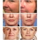 thumbnail image 4 of Retinol, esencia hidratante compacta que reduce los poros, botella pequeña, 20 ml., 4 of 5