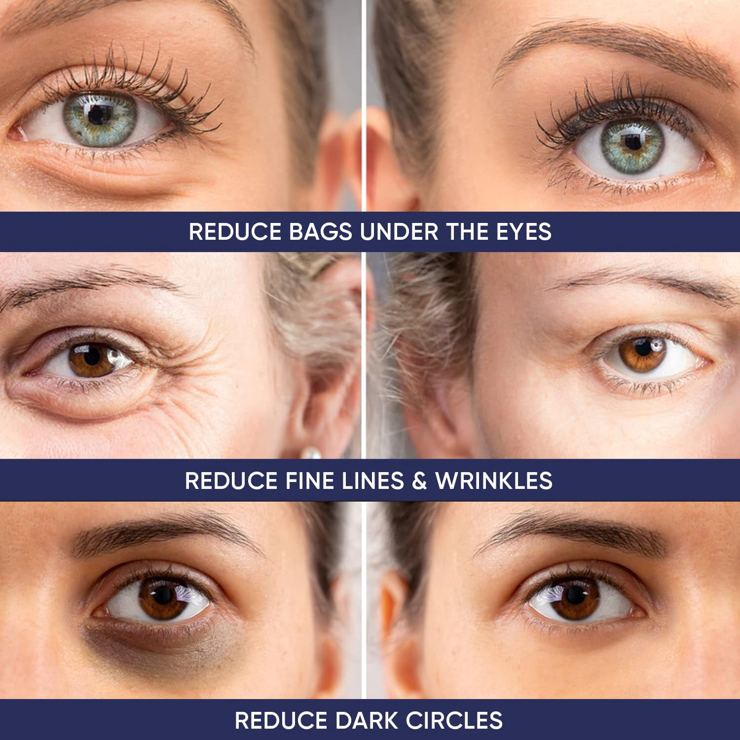 Instant Ageless Eye Cream Anti Wrinkle Cream, Removes Under Eye Puffiness, Bags, Expression Lines, & Dark Circles. Powerfully Tighen & Lifts Sagging Skin. Disappears Before Your Eyes In Minutes.