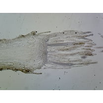 Moss Archegonia; Longitudinal Section by Go Science Crazy