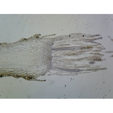 Moss Archegonia; Longitudinal Section by Go Science Crazy