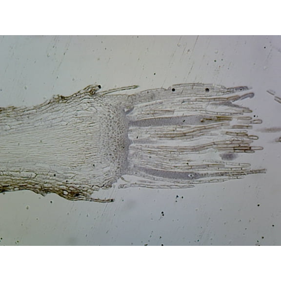 Moss Archegonia; Longitudinal Section by Go Science Crazy