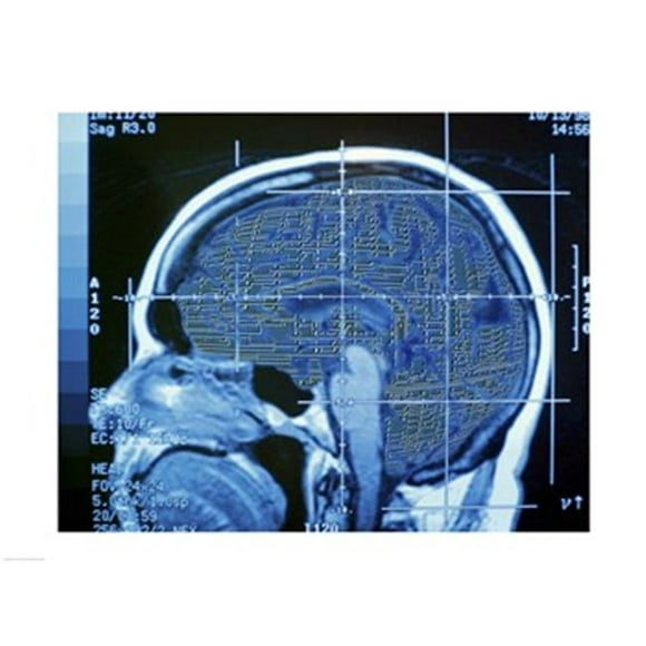 PVT/Superstock SAL1200135 Gros Plan d'Un Scanner MRI du Cerveau Humain -24 x 18- Affiche