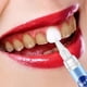 thumbnail image 3 of Blanqueamiento de instantáneo de Blanqueamiento de blanqueador Eliminar atención bucal Macarena Pluma de blanqueamiento dental, 3 of 5