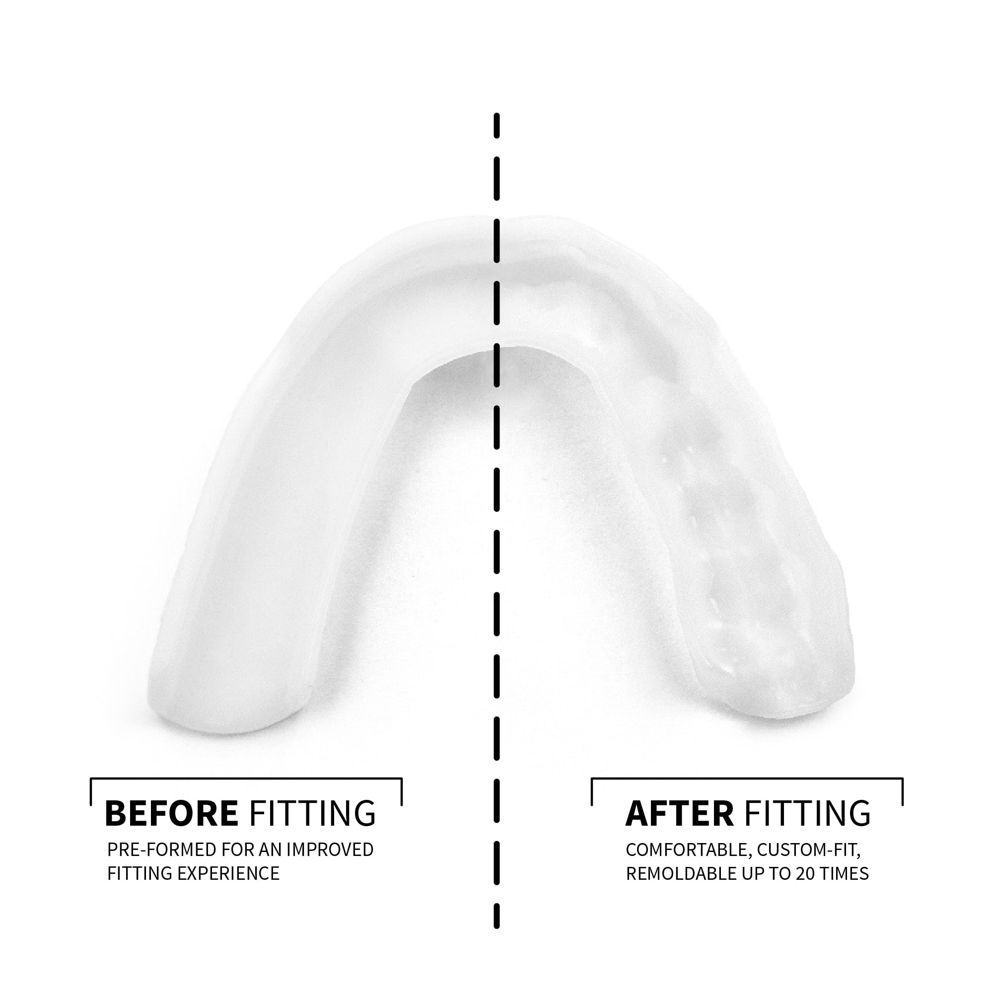 SOVA Night Guard - Protects Against Nighttime Teeth Grinding & Clenching