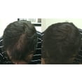 thumbnail image 2 of LUXE Hair Thickening Fibers with Natural Keratin-2 Months+ Supply!-Confidence in a Jar! - Gray  - Multiple Colors Available, 2 of 14