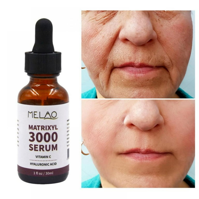3000 + Vitamin C Serum; Anti-Aging Face Serum Peptides for Face  Rejuvenation, Wrinkle Remover; Fragrance Free, Paraben Free