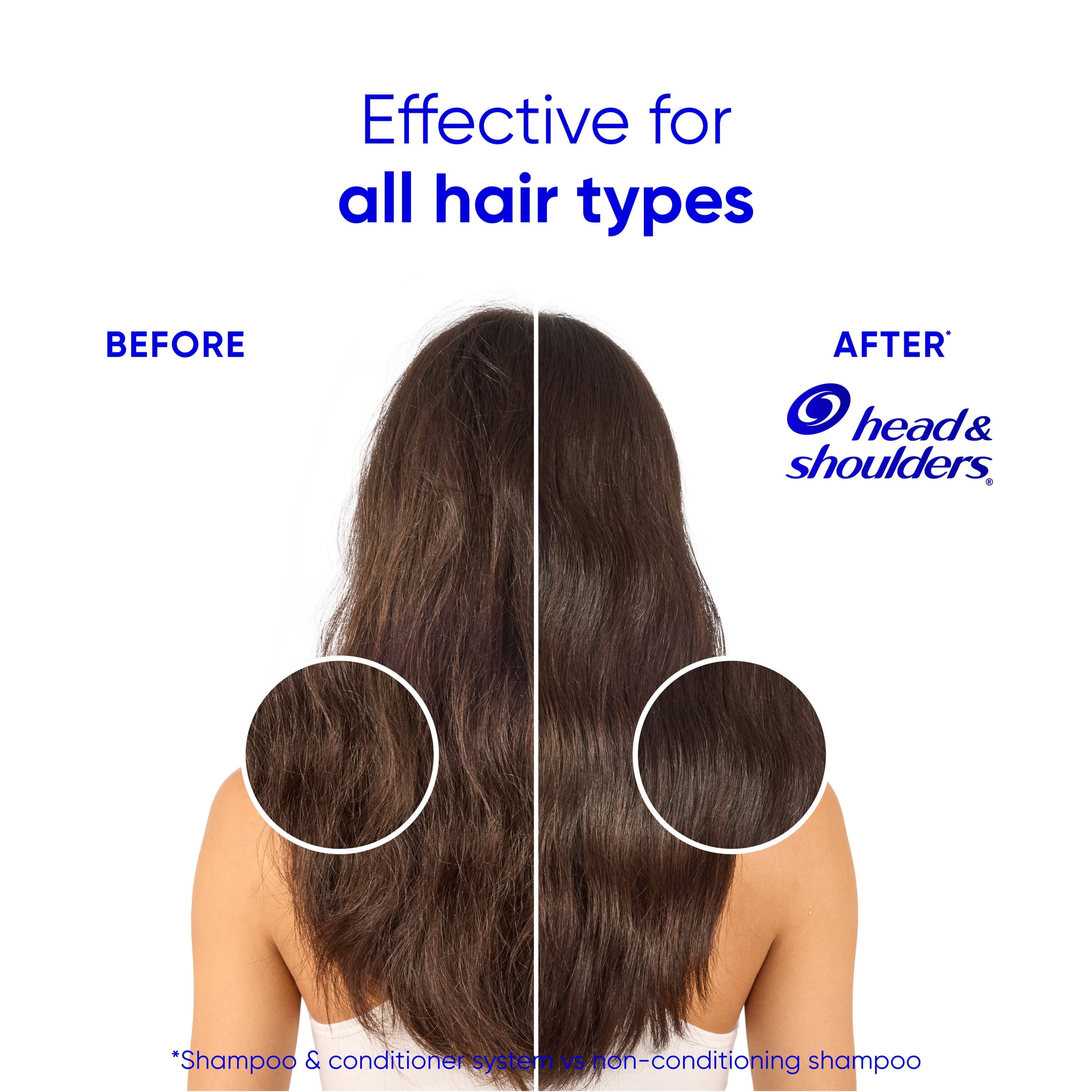 Head and Shoulders Smooth and Silky 2 in 1 Dandruff Shampoo and Conditioner, Frizz Control, Fresh Floral Scent, Color Safe, 28.2 fl oz