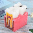 thumbnail image 3 of Modelo De Dientes, Modelo De Anatomía Dental Portátil Compacto De Resina Para El Cuidado Bucal Para Laboratorio Dental, 3 of 7