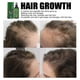 thumbnail image 3 of Líquido para el cuidado del cabello Qian Jaysuing, para fortalecer el cabello y prevenir el masaje de las raíces del cabello, líquido nutritivo para el cuero cabelludo grueso | 120 ml, 3 of 4