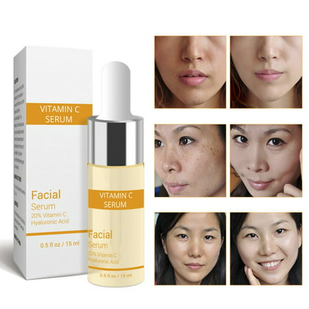 SUPERHOMUSE Vitamin C Serum For Face With Hyaluronic Acid Best Anti Aging Freckle Removal Moisturizing