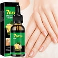 thumbnail image 4 of HHBEAUTY Ginger Nail Treatment Nail Support Nail Care, 7Days Nail Treatment Serum, Multi-Purpose Nail Repair,Nail Nutrient Oil Strengthener Oil Serum Ginger Nail Growth Oil, 4 of 8