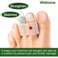 thumbnail image 4 of Welnove 6Pcs Hammer Toe Straightener Splints Cushioned Toe Wraps Cushioned Bandages Correct Bent Curled Overlapping Toes ,Beige, 4 of 7