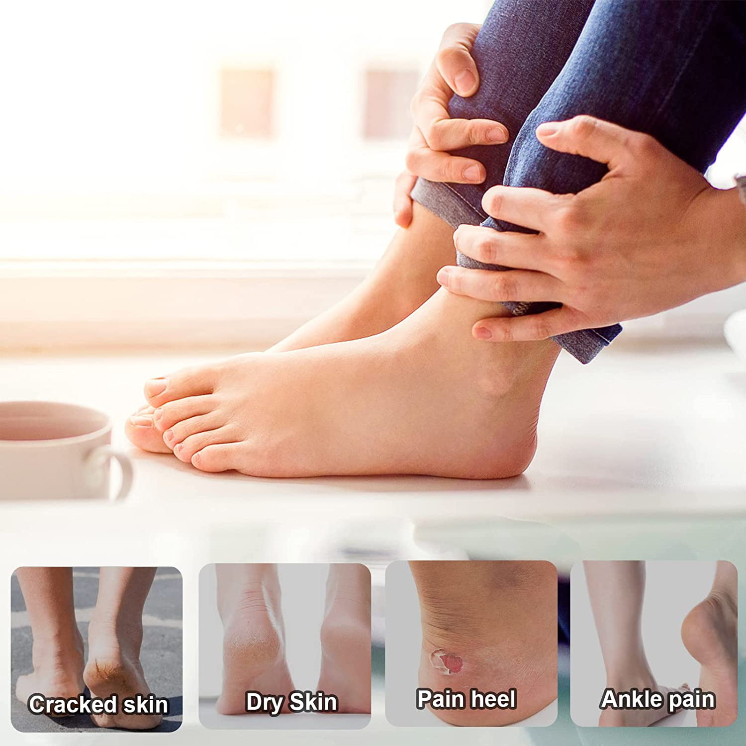 Dry Cracked Feet Fungus, Toenail Fungus, and Athlete's Foot Cures – Love,  Lori