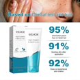 thumbnail image 3 of Crema depilatoria para labios, piernas, brazos, axilas, crema depilatoria suave, hidratante y limpiadora | 4251874434866,1 unidad, 3 of 5