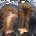 thumbnail image 7 of FIBR Hair Keratin Building Fibers, Fill In Fine and Thinning Hair for instant Full and Thick Look, Premium Hair Fibers For Both Men and Women (Blonde), 7 of 7
