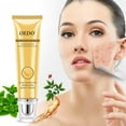thumbnail image 4 of Crema blanqueadora para el cuidado facial OEDO Repair Acne, 20 ml con ginseng, 4 of 4