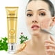 thumbnail image 4 of Crema blanqueadora para el cuidado facial OEDO Repair Acne, 20 ml con ginseng, 4 of 4