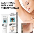 thumbnail image 4 of 3pcs Acanthosis Cream Nigrifix Cream For Acanthosis Nigricans Black Spot, 4 of 5