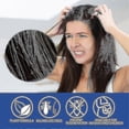 thumbnail image 2 of Head Lice Removal Spray Hair Removes Lice And Fleas Removes Lice Eggs And Pubic Lic, 2 of 5