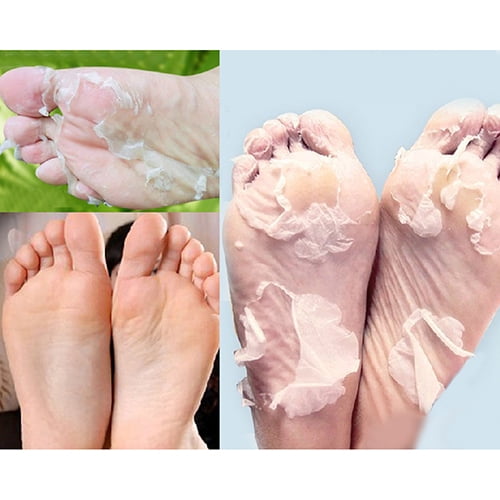 omvendt Betydning Snazzy Archer 2Pcs Milk Bamboo Vinegar Dead Skin Remove Foot Skin Smooth  Exfoliating Feet Mask | Walmart Canada