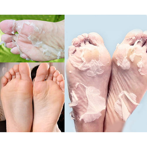 Kripyery 2Pcs Milk Bamboo Vinegar Dead Skin Remove Foot Skin Smooth  Exfoliating Feet Mask 