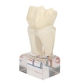 thumbnail image 4 of Modelo de nervio Dental profesional, modelo de dientes de demostración para estudio de enseñanza Dental, 4 of 5