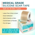 thumbnail image 4 of MEDLOT Silicone Scar Tape, Silicone Scar Sheets for Scar Treatment, Reusable, 1.5" x 78" Roll, 4 of 8