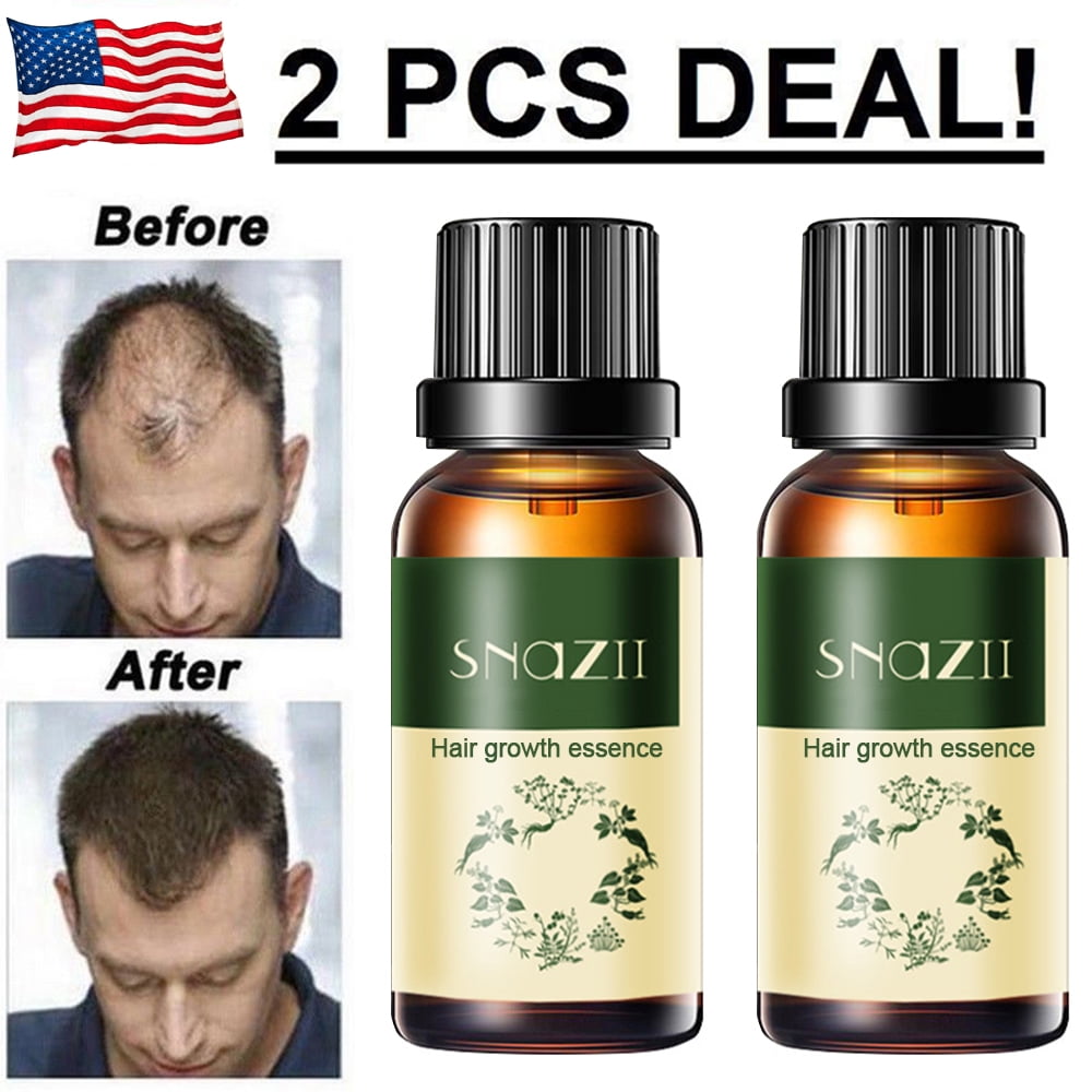 2 Pack Hair Growth Products For Men Women Natural Oil ...