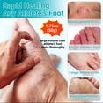 thumbnail image 2 of Crema de tratamiento para pies de atleta LMNOOP Maximum Strength, 2 of 9