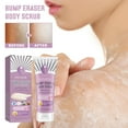Bump Eraser Body Scrub Exfoliant for Keratosis Pilaris with 10 AHA All