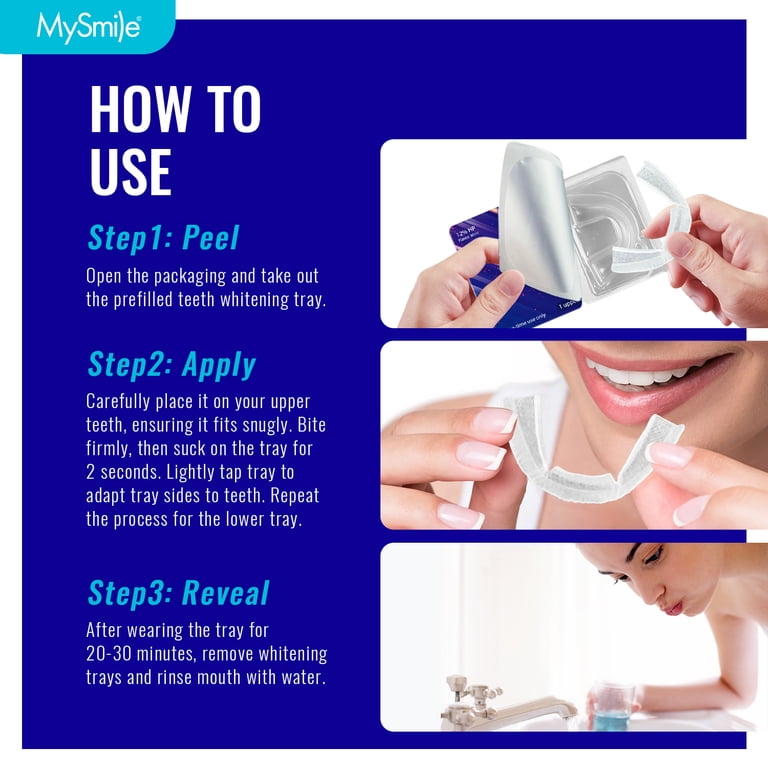 Prefilled Teeth Whitening Trays Kit, 7-Day Treatment photo 5