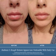 Admire My Skin Retinol + Vitamin C Hydrating Face Cream Moisturizer – Daily Skincare Treatment