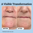 thumbnail image 5 of Vibriance Super C Serum for Mature Skin - All-in-One Vitamin Formula Hydrates, Firms, Lifts, Smooths, Targets Age Spots, Wrinkles, 1 fl oz, 5 of 9