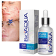 thumbnail image 1 of Serum Anti Acné UNIVERSOENLINEA.COM Bioaqua Pure Skin Cuidado Facial 1 Pieza, 1 of 8