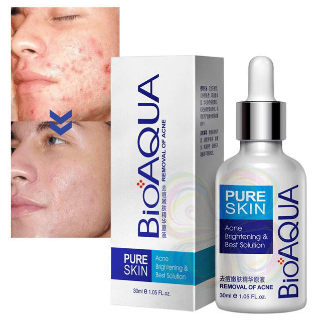 Serum Anti Acné UNIVERSOENLINEA.COM Bioaqua Pure Skin Cuidado Facial 1 Pieza