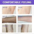 thumbnail image 4 of Gentle Hair Removal Cream for Sensitive Skin, Smooth Application with Shea Butter Enrichment, Soft Formula for Delicate Areas, 4 of 5