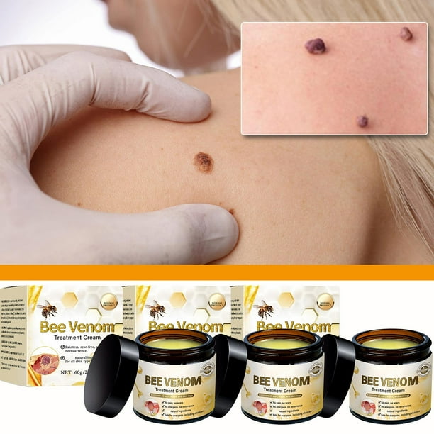 Bee fluids Cream, PLTOWE Bee fluids, All-in-One Cream, 2025 New Bee fluidsSkin Treatment Cream,Visibly reduces skin blemishes and smoothes skin Professional Bee Repair Cream for All Skin Types