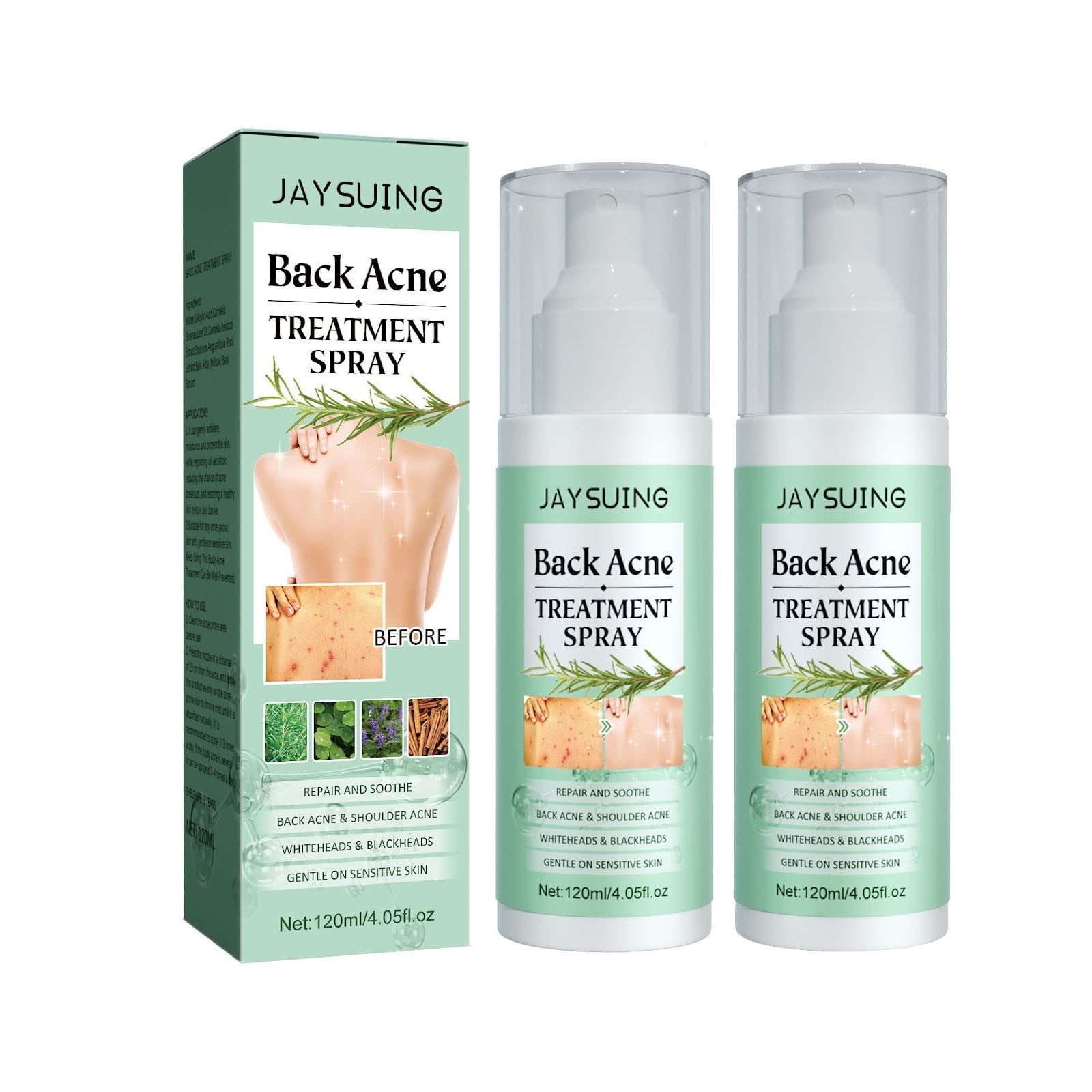 WUXICHEN Toxiklenz Back Acne Treatment Spray Herbaluxy Back Acne