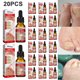 thumbnail image 5 of 20 Piezas 10ml para Uñas Encarnadas Unisex Cuidado La Las, 5 of 8