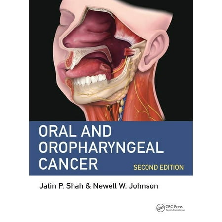 UPC: 9781498700085 | Oral and Oropharyngeal Cancer (Hardcover)