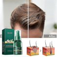 thumbnail image 2 of 3pcs Hair Growth Dense Spray Regrowth Essence Herbal Ginger Anti-loss Treatment Serum, 2 of 5