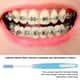 thumbnail image 5 of Cepillo De Dientes Cepillo De Dientes Para El Cuidado Bucal Cepillo De Dientes Dental Cepillo De Dientes Suave Ortodoncia Cepillo De Dientes Limpieza Bucal Cuidado Dental Cabello Amonsee Soft Toothbrush, 5 of 8