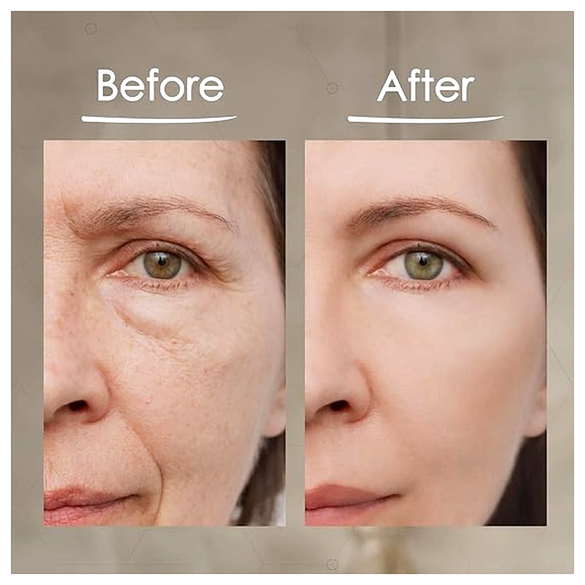 BioLogic Solutions MaxiLift Serum, Instant Face Lift Cream, Skin Tightening Serum for Face & Instant Eye Lift, Smooth & Firm Loose Sagging Skin, Fine Lines & Wrinkles Within 2 Minutes, 0.5 Fl Oz