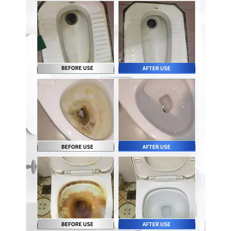 Dpityserensio Cleaning Supplies Shuwanjia Toilet Live Oxygen Net Toilet  Clean Toilet Spirit Toilet Cleaner Toilet Cleaning Artifact