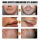 thumbnail image 5 of 30ml Aceite para el crecimiento de la barba para hombres Spray nutritivo para el crecimiento del cabello / 1 Derma Roller, 5 of 5