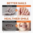 thumbnail image 4 of Los modelos de bolígrafo para morderse las uñas detienen la prevención de morderse las uñas, 4 of 8