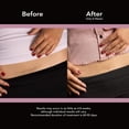 thumbnail image 3 of ScarAway C-Section Scar Treatment Strips, Silicone Adhesive Soft Fabric (7 X 1.5 Inch) by ScarAway, 3 of 4