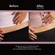 thumbnail image 3 of ScarAway C-Section Scar Treatment Strips, Silicone Adhesive Soft Fabric (7 X 1.5 Inch) by ScarAway, 3 of 4