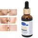 thumbnail image 4 of Suero Facial Suero Hidratante Tratamiento Para El Acné Suero Para Eliminar El Acné Suero Hidratante Antiacné Suero Facial Tratamiento Para El Acné Solución De Suero Calmante ANGGREK Otros, 4 of 8